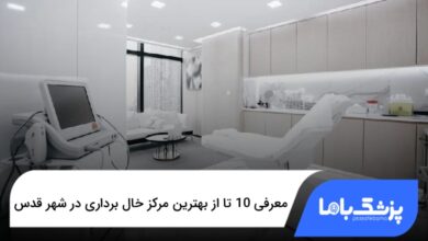 بهترین مرکز خال برداری در شهر قدس