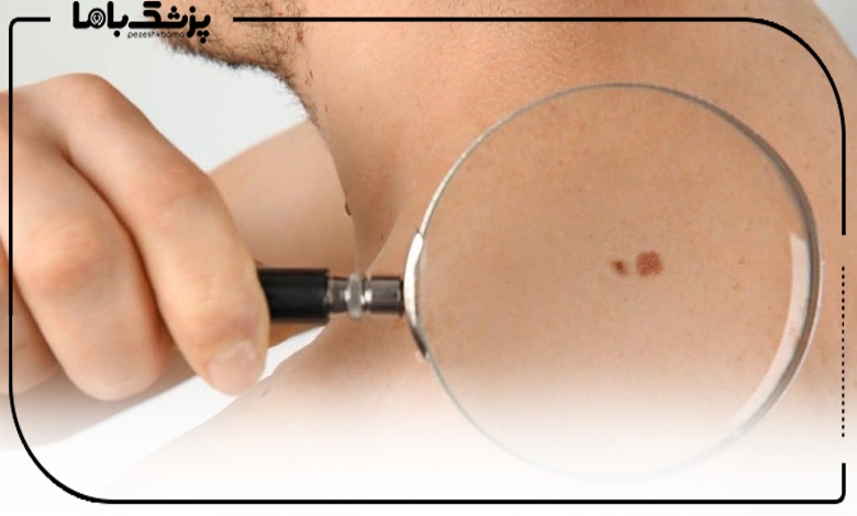 مراحل خالبرداری از معاینه تا نتیجه نهایی در شهر قدس