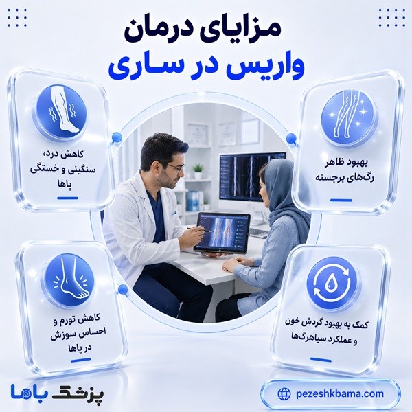 مزایای درمان واریس در ساری