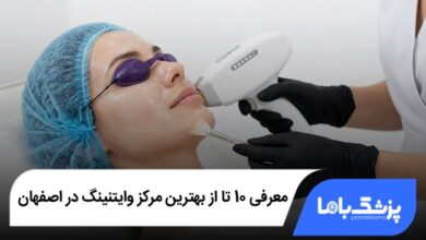 بهترین مرکز وایتنینگ در اصفهان