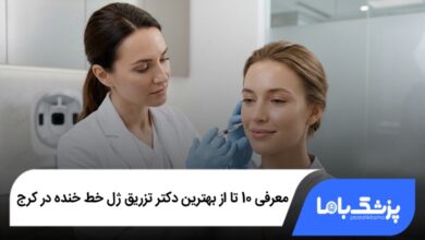 بهترین دکتر تزریق ژل خط خنده در کرج