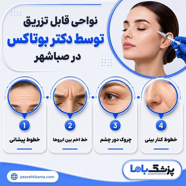 نواحی قابل تزریق توسط دکتر بوتاکس در صبا شهر