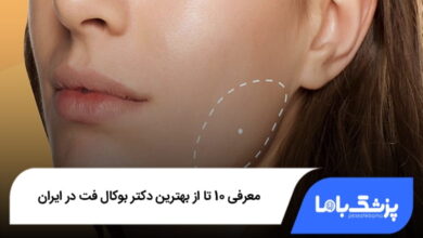 بهترین دکتر بوکال فت در ایران