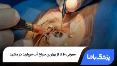 بهترین جراح آب مروارید در مشهد