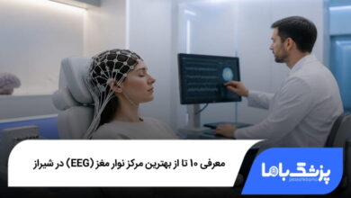 بهترین مرکز نوار مغز (EEG) در شیراز