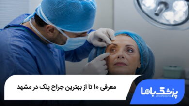 بهترین جراح پلک در مشهد