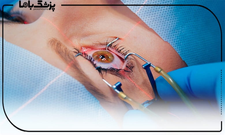 بهترین جراح فمتولیزیک را چگونه انتخاب کنیم؟