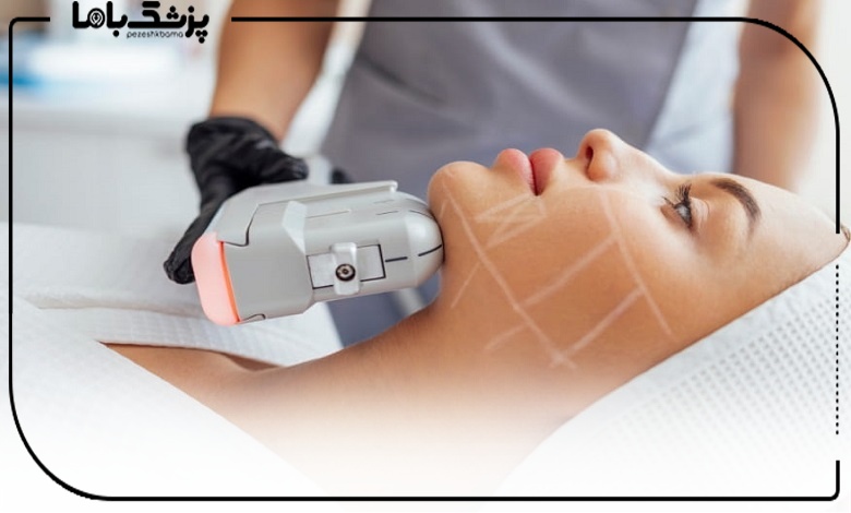 هایفوتراپی بهتر است یا آر اف فرکشنال؟