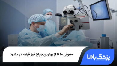 بهترین جراح قوز قرنیه در مشهد