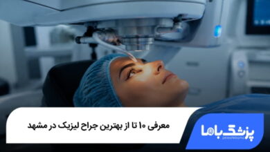 بهترین جراح لیزیک در مشهد