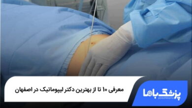 بهترین دکتر لیپوماتیک در اصفهان