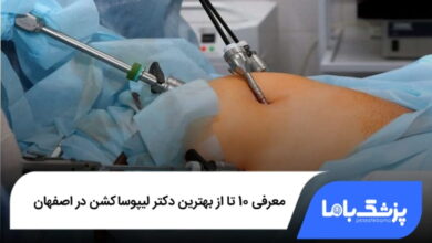 بهترین دکتر لیپوساکشن در اصفهان