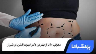 بهترین دکتر لیپوساکشن در شیراز