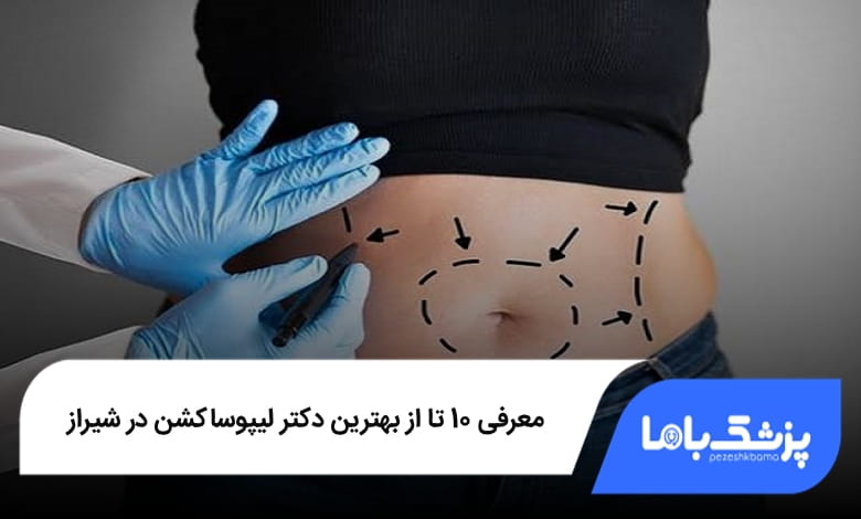 بهترین دکتر لیپوساکشن در شیراز