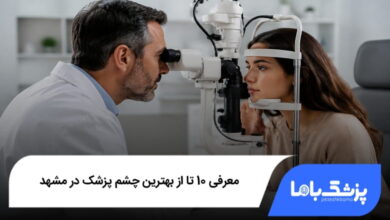 بهترین چشم پزشک در مشهد