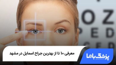 بهترین جراح اسمایل در مشهد
