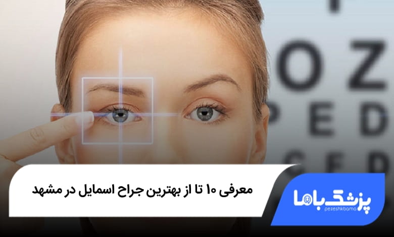بهترین جراح اسمایل در مشهد