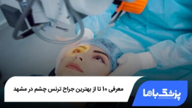 بهترین جراح ترنس چشم در مشهد