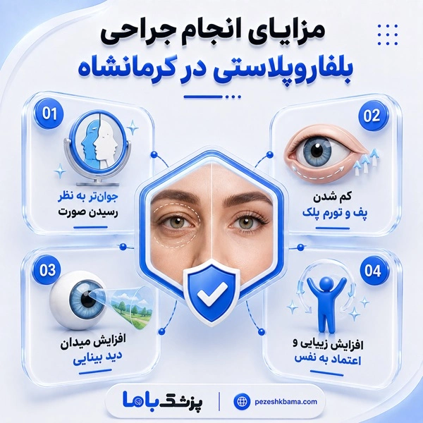 مزایای انجام جراحی بلفاروپلاستی در کرمانشاه