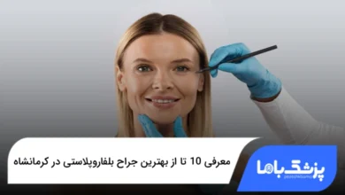بهترین جراح بلفاروپلاستی در کرمانشاه