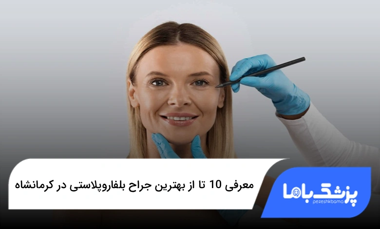 بهترین جراح بلفاروپلاستی در کرمانشاه