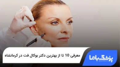 بهترین دکتر بوکال فت در کرمانشاه