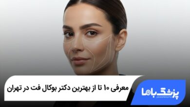 بهترین دکتر بوکال فت در تهران