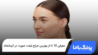 بهترین جراح لیفت صورت در کرمانشاه