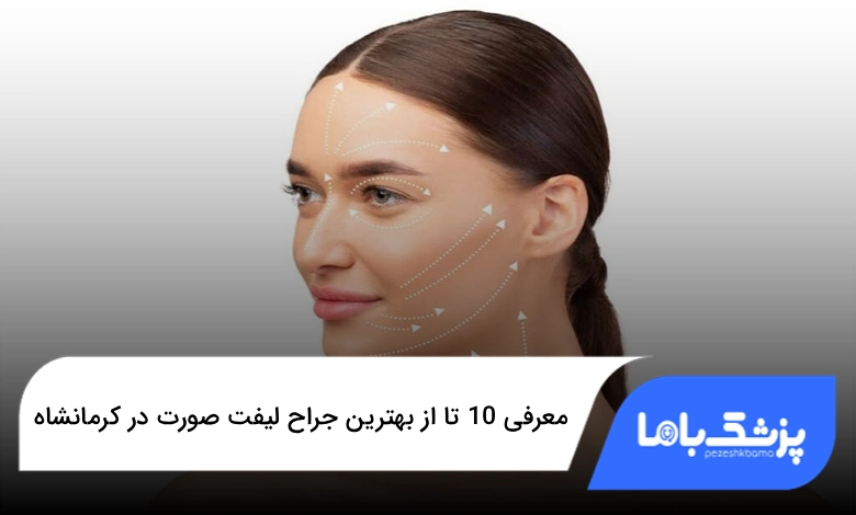 بهترین جراح لیفت صورت در کرمانشاه