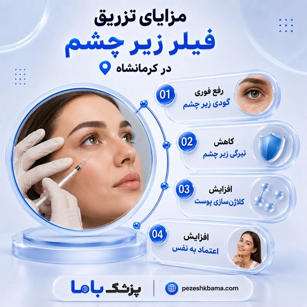 مزایای تزریق فیلر زیر چشم در کرمانشاه