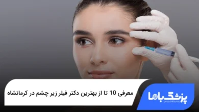 بهترین دکتر فیلر زیر چشم در کرمانشاه