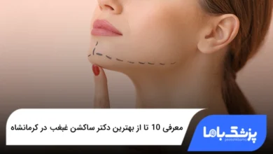 بهترین دکتر ساکشن غبغب در کرمانشاه