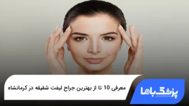 بهترین جراح لیفت شقیقه در کرمانشاه