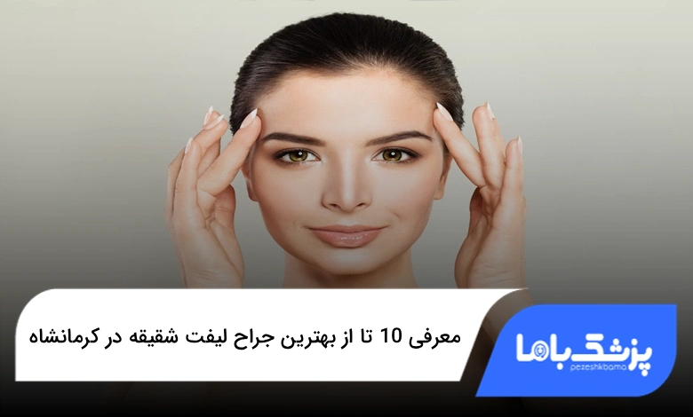 بهترین جراح لیفت شقیقه در کرمانشاه