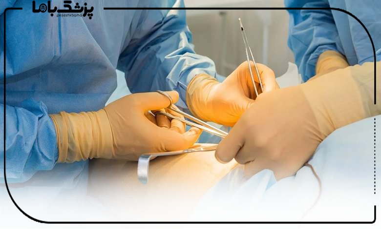 جراحی ابدومینوپلاستی توسط متخصص کرمانشاه