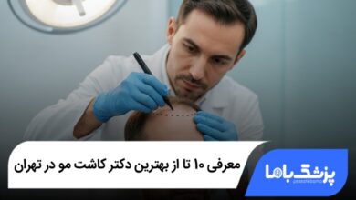 بهترین دکتر کاشت مو در تهران