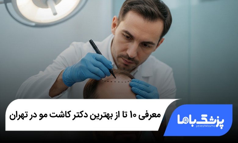 بهترین دکتر کاشت مو در تهران