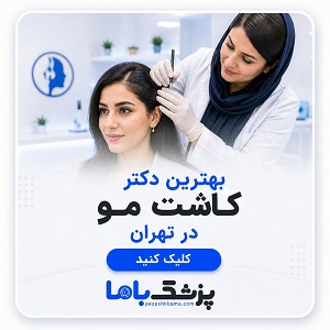 بهترین دکتر کاشت مو در تهران
