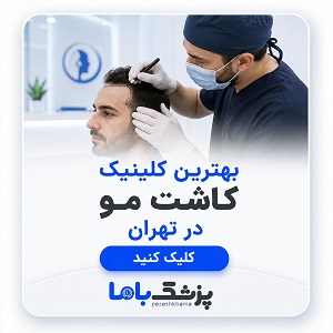 بهترین کلینیک کاشت مو در تهران