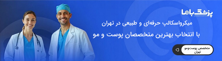 میکرواسکالپ سر برای چه کسانی مناسب است؟