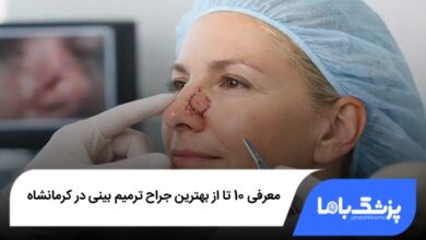 بهترین جراح ترمیم بینی در کرمانشاه