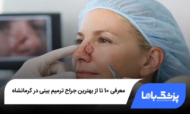 بهترین جراح ترمیم بینی در کرمانشاه