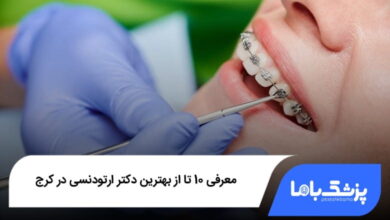 بهترین دکتر ارتودنسی در کرج