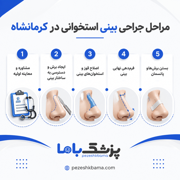 مراحل جراحی بینی استخوانی در کرمانشاه