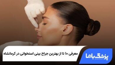 بهترین جراح بینی استخوانی در کرمانشاه