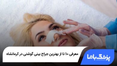 بهترین جراح بینی گوشتی در کرمانشاه