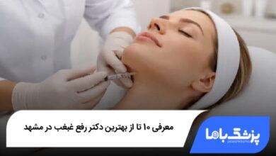 بهترین دکتر رفع غبغب در مشهد