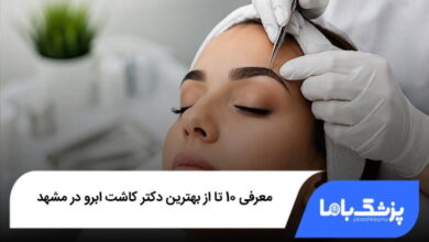 بهترین دکتر کاشت ابرو در مشهد