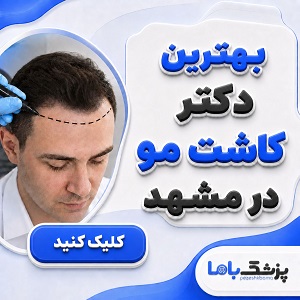 بهترین دکتر کاشت مو در مشهد