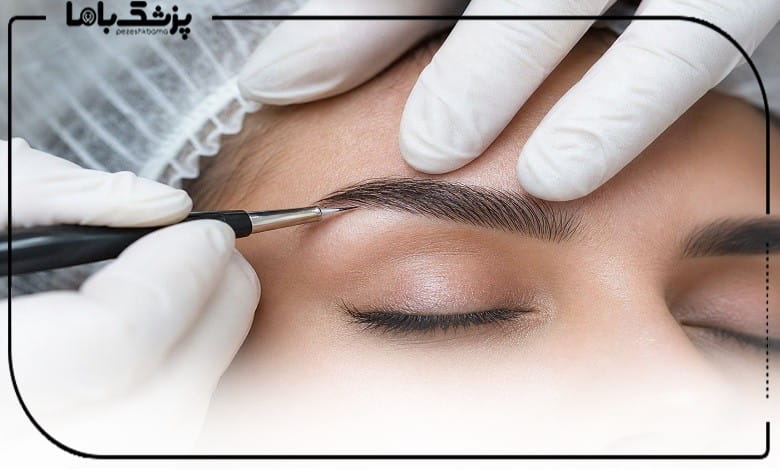 کاشت ابرو مشهد برای چه کسانی مناسب است؟
